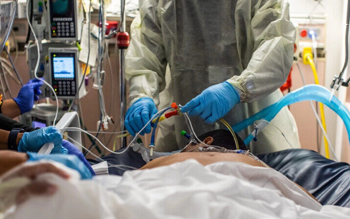 Trabajadores de la salud atienden a un paciente en la Unidad de Cuidados Intensivos Cardiovasculares del Centro Médico Providence Cedars-Sinai Tarzana, en Tarzana, California, el 2 de septiembre de 2021. (Apu Gomes/AFP vía Getty Images)