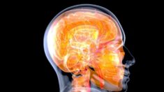Ciertos progestágenos se asocian con el riesgo de desarrollar tumores cerebrales dice estudio