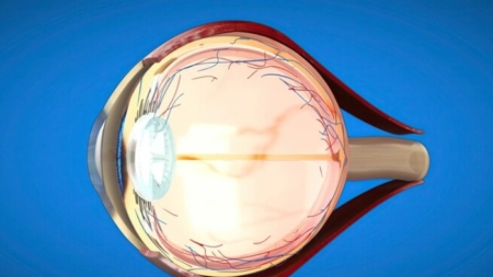 Estudio revela riesgo elevado de trastorno inflamatorio ocular después de la vacuna contra COVID-19