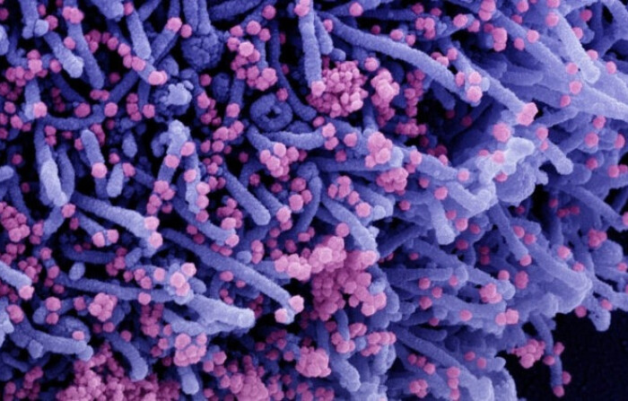 Micrografía electrónica de barrido coloreada de una célula (púrpura) infectada con una cepa variante de partículas del virus SARS-CoV-2 (rosa), aislada de una muestra de un paciente. (NIAID vía The Epoch Times)