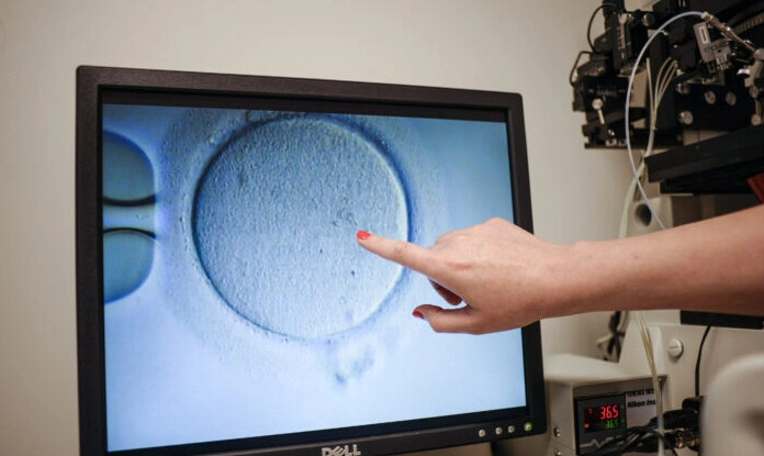 Un embriólogo muestra un ovocito después de ser inseminado en el Centro de Medicina Reproductiva de Virginia, en Reston, Virginia, el 12 de junio de 2019. (Ivan Couronne/AFP vía Getty Images)

