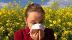 4 tratamientos naturales para aliviar las alergias