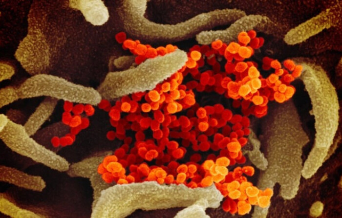 Esta imagen de microscopio electrónico de barrido muestra el nuevo coronavirus (naranja), causante de la enfermedad COVID-19, aislado de un paciente en EE.UU., emergiendo de la superficie de células (verde) cultivadas en el laboratorio. Foto publicada el 13 de febrero de 2020. (NIAID-RML)