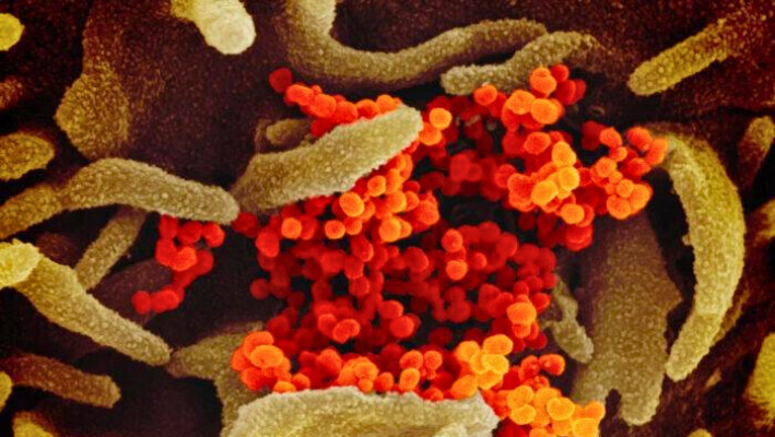 Esta imagen de microscopio electrónico de barrido muestra el virus que causa el COVID-19. (Institutos Nacionales de Salud de EE. UU.)