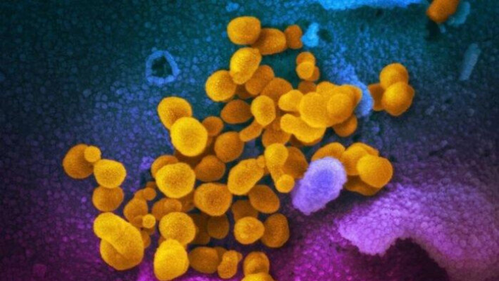 Esta imagen de microscopio electrónico sin fecha proporcionada por los Institutos Nacionales de Salud de EE. UU. en febrero de 2020 muestra el nuevo coronavirus SARS-CoV-2, amarillo, emergiendo de la superficie de células, azul/rosa, cultivadas en el laboratorio. También conocido como 2019-nCoV, el virus causa el COVID-19. (NIAID-RML/AP/Prensa canadiense)