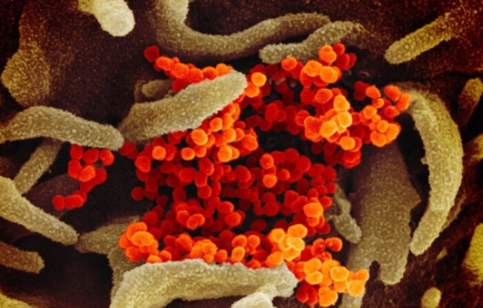 Esta imagen de microscopio electrónico de barrido muestra el nuevo coronavirus (naranja), causante de la enfermedad COVID-19, aislado de un paciente en Estados Unidos, emergiendo de la superficie de células (verde) cultivadas en el laboratorio. Imagen publicada el 13 de febrero de 2020. (Cortesía de NIAID-RML)
