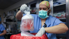 Muere primera mujer que recibe transplante de riñon de cerdo 47 días después de la cirugía