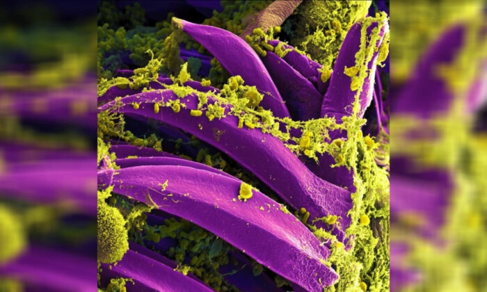 Imagen de la bacteria de la peste Yersinia pestis en una foto de archivo. (Instituto Nacional de Alergias y Enfermedades Infecciosas de EE. UU.)