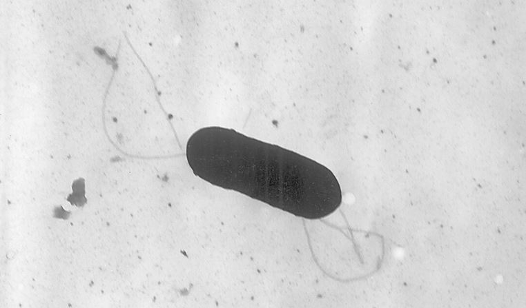 Imagen de un microscopio electrónico de 2002 facilitada por los Centros para el Control y la Prevención de Enfermedades (CDC) muestra una bacteria Listeria monocytogenes, responsable de la enfermedad de transmisión alimentaria, listeriosis. (Elizabeth White/CDC vía AP, Archivo)