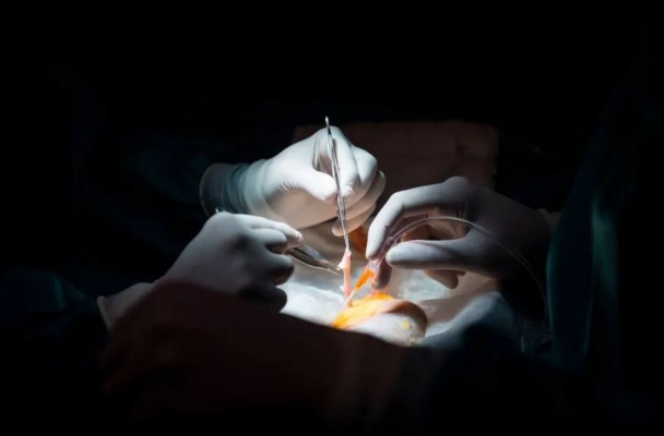 Los médicos se preparan para un trasplante de riñón en una fotografía de archivo. (Pierre-Philippe Marcou/AFP/Getty Images)