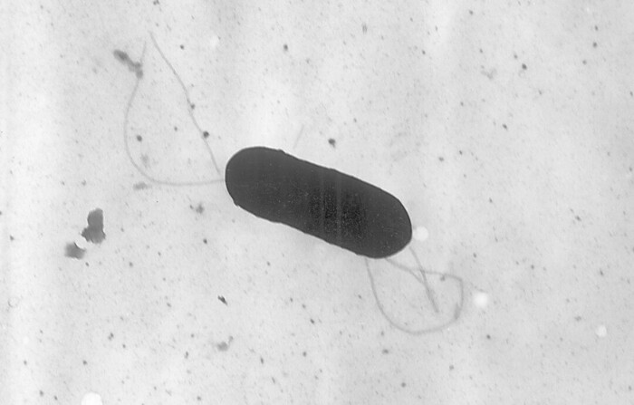 Esta imagen de microscopio electrónico de 2002 facilitada por los Centros para el Control y la Prevención de Enfermedades muestra una bacteria Listeria monocytogenes, responsable de la listeriosis, una enfermedad de transmisión alimentaria. (Elizabeth White/CDC vía AP)
