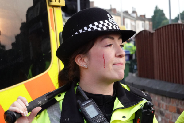 Una agente de policía herida contiene a los manifestantes después de que estallara el desorden el 30 de julio de 2024 en Southport, Inglaterra. (Getty Images)