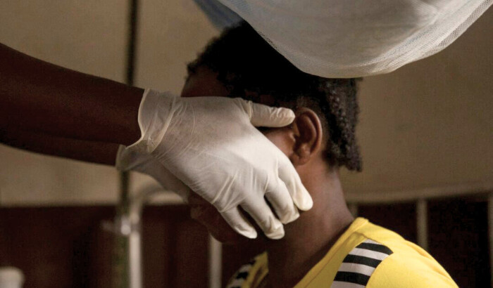 Un médico examina a una mujer infectada con viruela del mono en Zomea Kaká, en la República Centroafricana, el 18 de octubre de 2018. (Charles Bouessel/AFP/Getty Images)