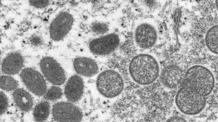 Esta imagen de microscopio electrónico de 2003 facilitada por los Centros para el Control y la Prevención de Enfermedades muestra viriones maduros de viruela del mono de forma ovalada (L) y viriones inmaduros esféricos (R) obtenidos de una muestra de piel humana asociada al brote de perrito de las praderas de 2003. (Cynthia S. Goldsmith, Russell Regner/CDC vía AP)