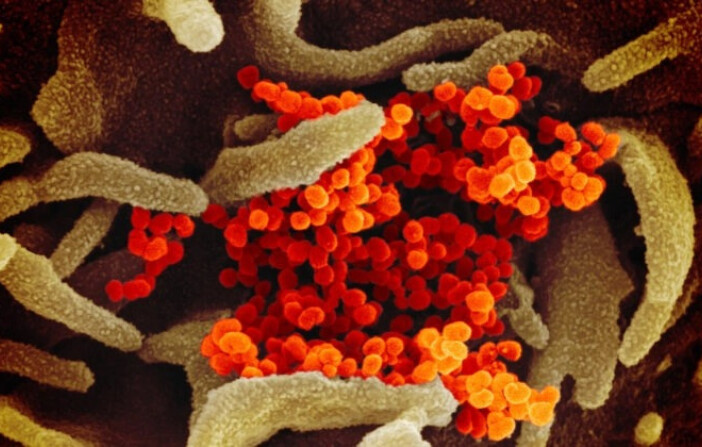 Esta imagen de microscopio electrónico de barrido muestra el nuevo coronavirus (naranja), causante de la enfermedad COVID-19, aislado de un paciente en EE.UU., emergiendo de la superficie de células (verde) cultivadas en el laboratorio. Foto publicada el 13 de febrero de 2020. (NIAID-RML). 
