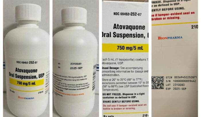 Una combinación de fotos muestra la suspensión oral de atovacuona, 750 mg/mL, para la cual la compañía emitió un retiro voluntario a nivel nacional debido a una posible contaminación bacteriana. (Bionpharma Inc. a través de la FDA)