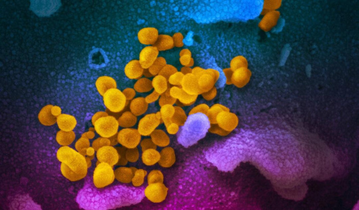 El virus COVID-19 se ve en amarillo, emergiendo de las células. (NIAID)(en inglés)