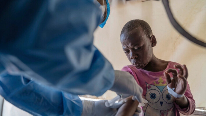 Un trabajador de la salud atiende a un paciente con mpox en un centro de tratamiento en Munigi, al este del Congo, el 19 de agosto de 2024. (AP Photo/Moses Sawasawa, Archivo). 