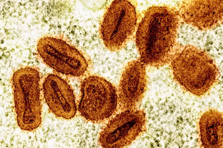 Esta imagen coloreada de microscopio electrónico proporcionada por el Instituto Nacional de Alergias y Enfermedades Infecciosas en 2024 muestra partículas del virus Mpox, de color naranja, que se encuentran dentro de células infectadas, de color verde. (NIAID vía AP, Archivo)