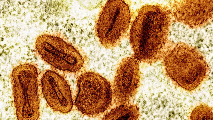 Una imagen de microscopio electrónico coloreada muestra partículas del virus Mpox (naranja) dentro de células infectadas (verde). (NIAID vía AP).