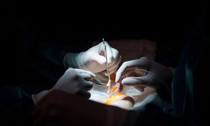 Médicos se preparan para un trasplante de riñón en una foto de archivo. (Pierre-Philippe Marcou/AFP/Getty Images)