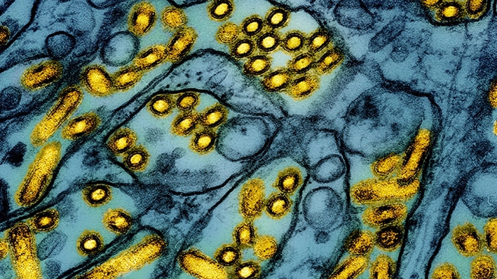 Esta imagen tomada con microscopio electrónico y publicada por el Instituto Nacional de Alergias y Enfermedades Infecciosas el 26 de marzo de 2024 muestra partículas del virus de la influenza aviar A H5N1 (amarillo), cultivadas en células epiteliales de un riñón canino Madin-Darby (MDCK) (azul). (CDC/NIAID vía AP, Archivo)