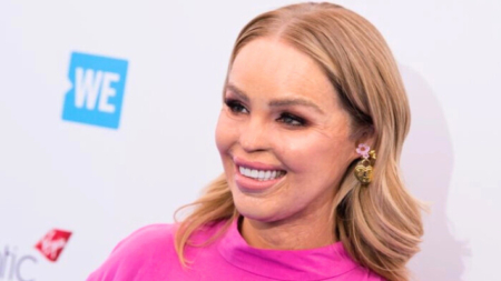 Katie Piper decide ponerse un «ojo artificial» 17 años después de sobrevivir a ataque con ácido