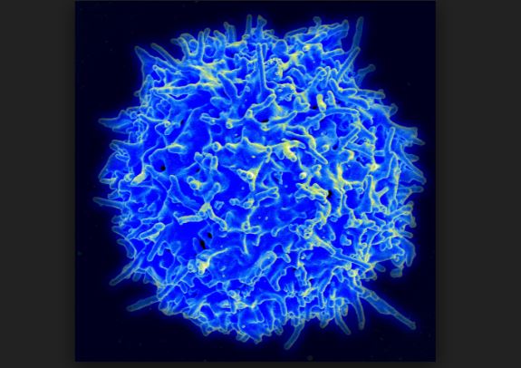 Linfocito T, también conocido como Célula T,  en un scaneo electrónico micrográfico ( NIAID/ Wikimedia Common)